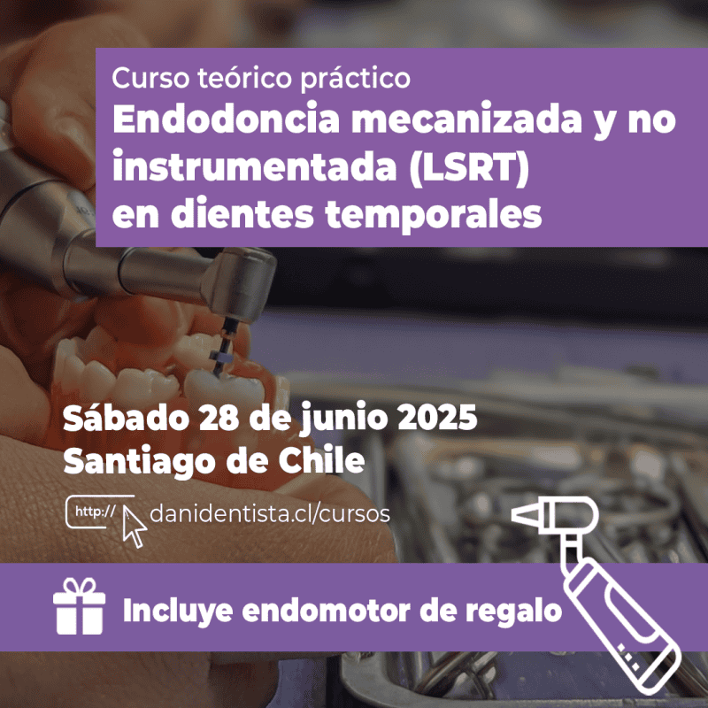 Endodoncia mecanizada y LSRT en dientes temporales - 28 junio 2025